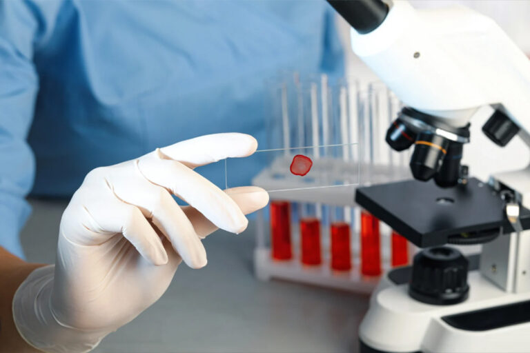 Live Blood Cell Microscopy