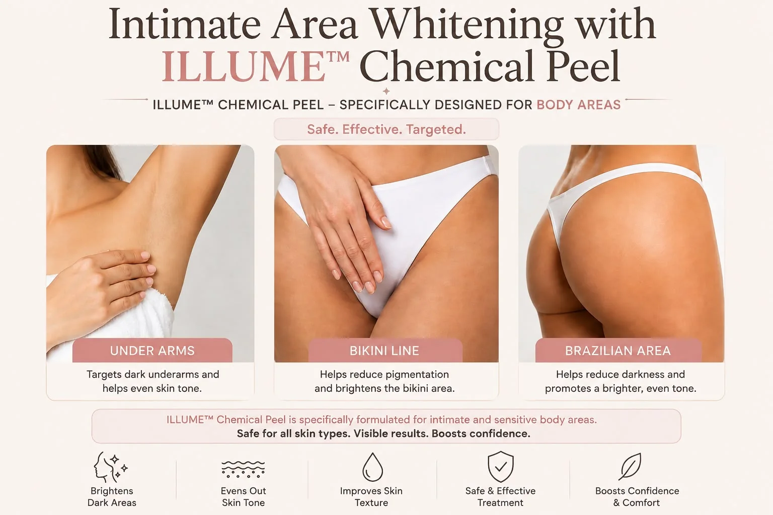 Infographic showing common external treatment areas for Illume intimate brightening